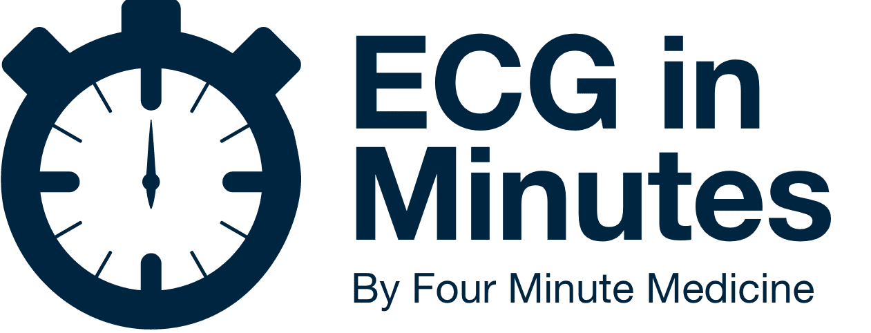 ECG In Minutes